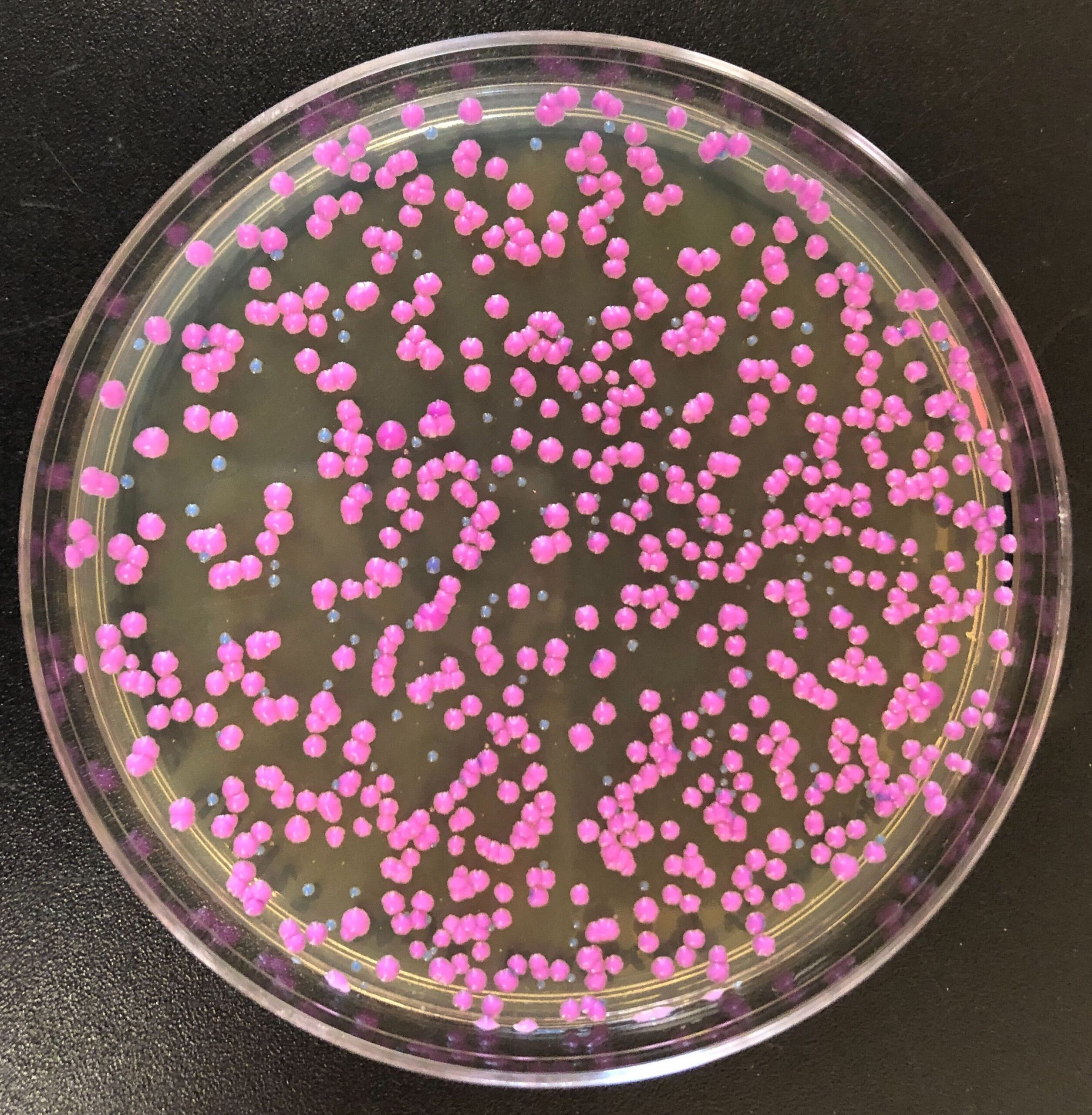 a Petri dish with colonies of pink and blue yeast